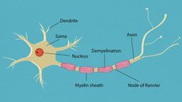 What Is Guillain-Barré Syndrome? Symptoms, Causes, Diagnosis, Treatment,  and Prevention