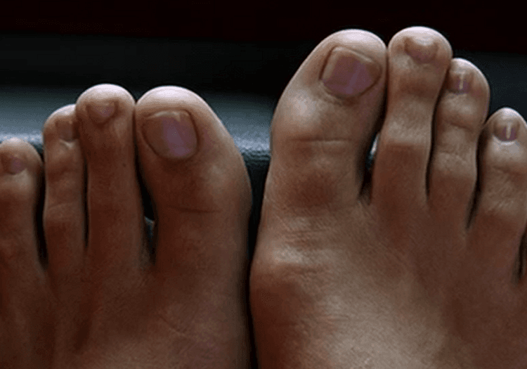 A toe in Kill Bill